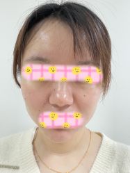 体验后-北京爱育华医院-医疗美容科