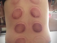 -莱蔻·圣灸堂·推拿艾灸(天山店)