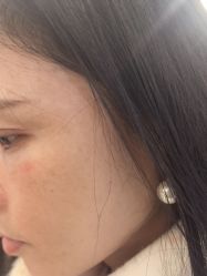 -长沙雅美医疗美容医院
