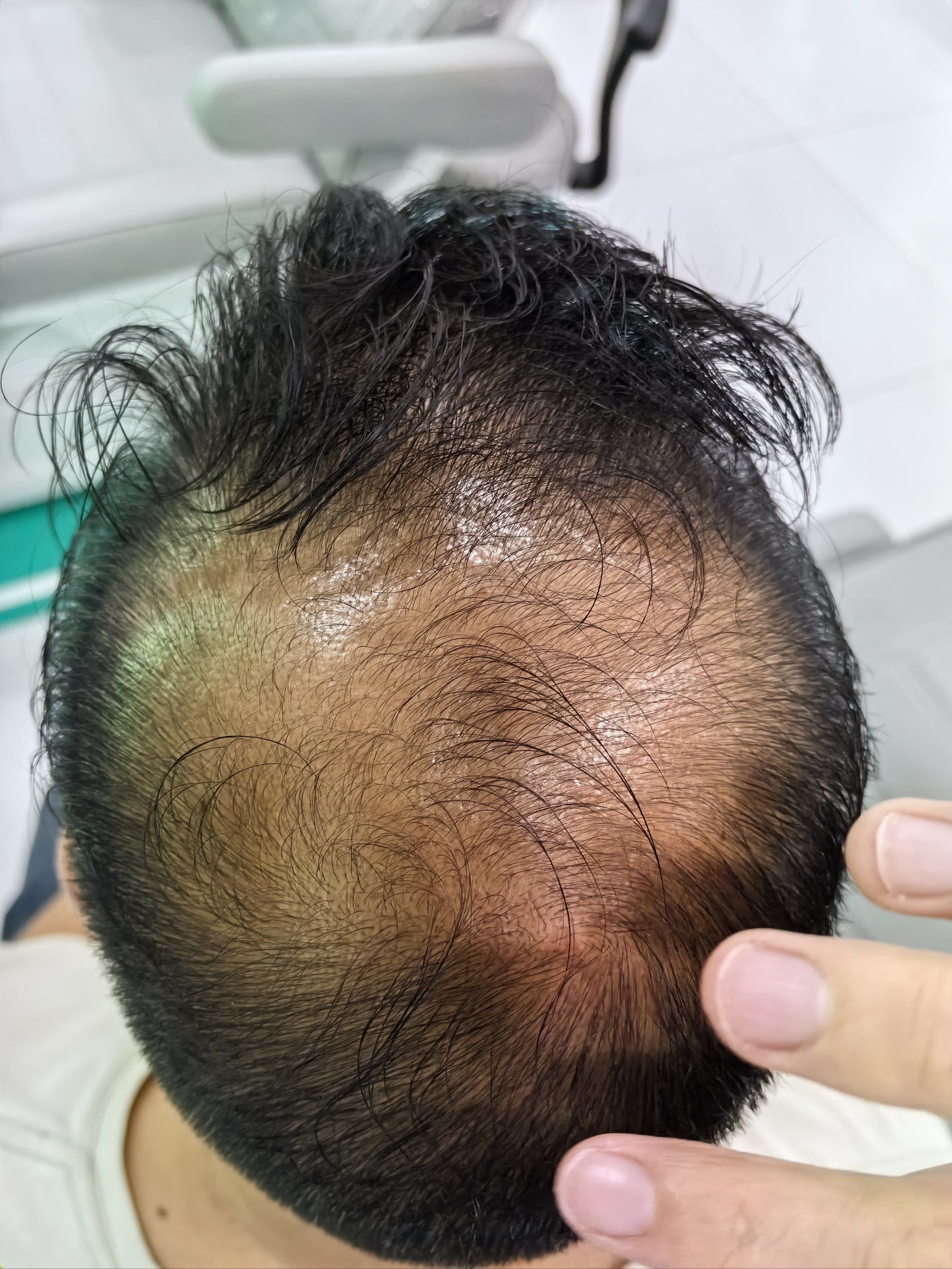 秃头人士怎么留发型