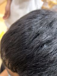 -熙朵美学植发·连锁品牌