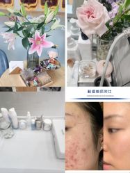 -靓芙泉祛痘.科技美肤连锁