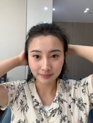 -大麦微针植发全国连锁