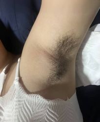 -薇兰专业脱毛连锁机构