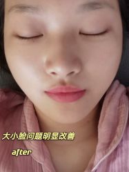 -安徽合肥韩美整形外科医院