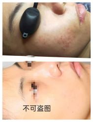 -ROYEA茹彦祛痘·问题肌肤修护中心