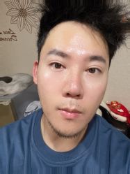 -成都西区医院整形美容