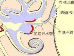 -AudioNova 海之声助听器峰力助听器索诺瓦自营店(北京店)