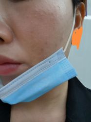 体验后-苏州卫康美容医院
