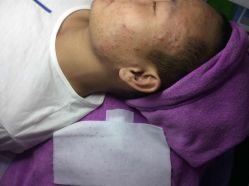 -瑶芳·痘院士专业祛痘·皮肤管理