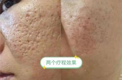 -+MS卓美丝专业祛痘·皮肤管理中心