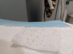 -苑苑vbeauty科技美容SPA