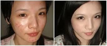 -SKINIST丽铂医疗美容