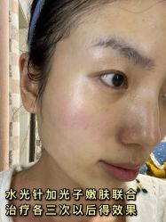 -繁星轻医美连锁