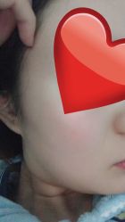 -纯粹医美