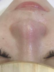 点击看大图 -美肤盾祛痘·问题肌头疗管理中心