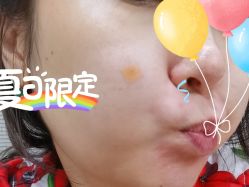 体验后-恒妍医美·韩国定制抗衰中心
