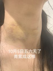 体验后-Yestar艺星医疗美容医院