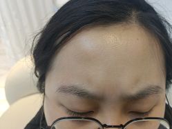 -洁铭新加坡医美