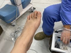 -Andrew指甲专科灰指甲·甲沟炎矫正·3D步态矫形鞋垫定制(浦三路店)
