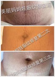 -美丽妈妈产后恢复中心(城西力盟国芳店)