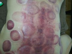 -真功夫足浴按摩