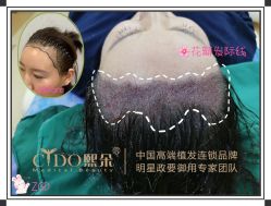 -熙朵美学植发·连锁品牌