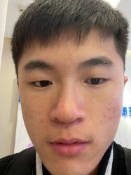 体验前-郑荃丽格医疗美容