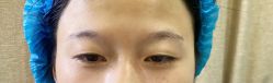 点击看大图 体验前-重庆联合丽格第五医疗美容医院