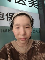-BR光电保养