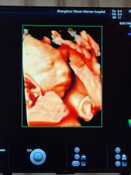 -郑州万安妇产医院