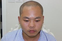 点击看大图 -大麦微针植发丨全国连锁