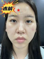 -素美医疗美容·西南眼鼻整形·修复基地