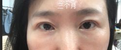 -八大处整形