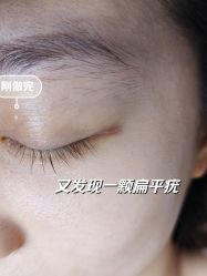 -清疣美疣·痣·斑净肤中心