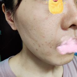 体验前-广州美莱医疗美容医院