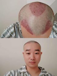 -雍禾植发全国连锁