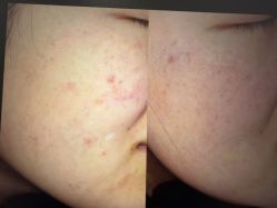 -和颜一美轻医美连锁