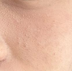 体验前-重庆军科整形美容医院