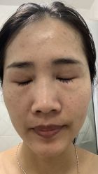 体验前-南宁华美医疗美容医院