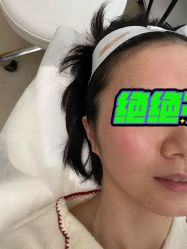 体验前-BR光电保养