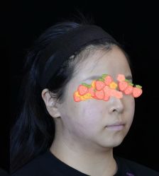 -Yestar重庆艺星医疗美容医院