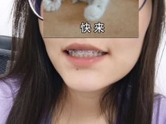 -极光口腔·矫正种植修复(锦江店)