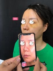 -北京米扬丽格医疗美容·联合丽格鼻整形中心