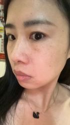 -广州健丽·去眼袋医疗美容机构