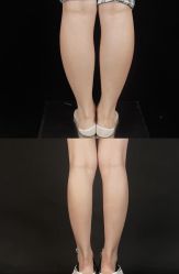 -Lily纤美·科技减脂中心