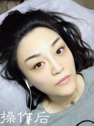 点击看大图 -西施无菌半永久纹绣眉眼影唇轻增发纹发际线