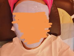 -成都苗方清颜专业祛痘