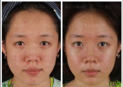 -北京米扬丽格医疗美容·联合丽格鼻整形中心