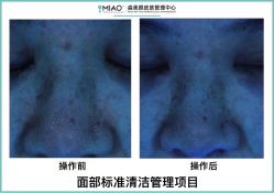 -韩国淼美颜皮肤管理官方直营店